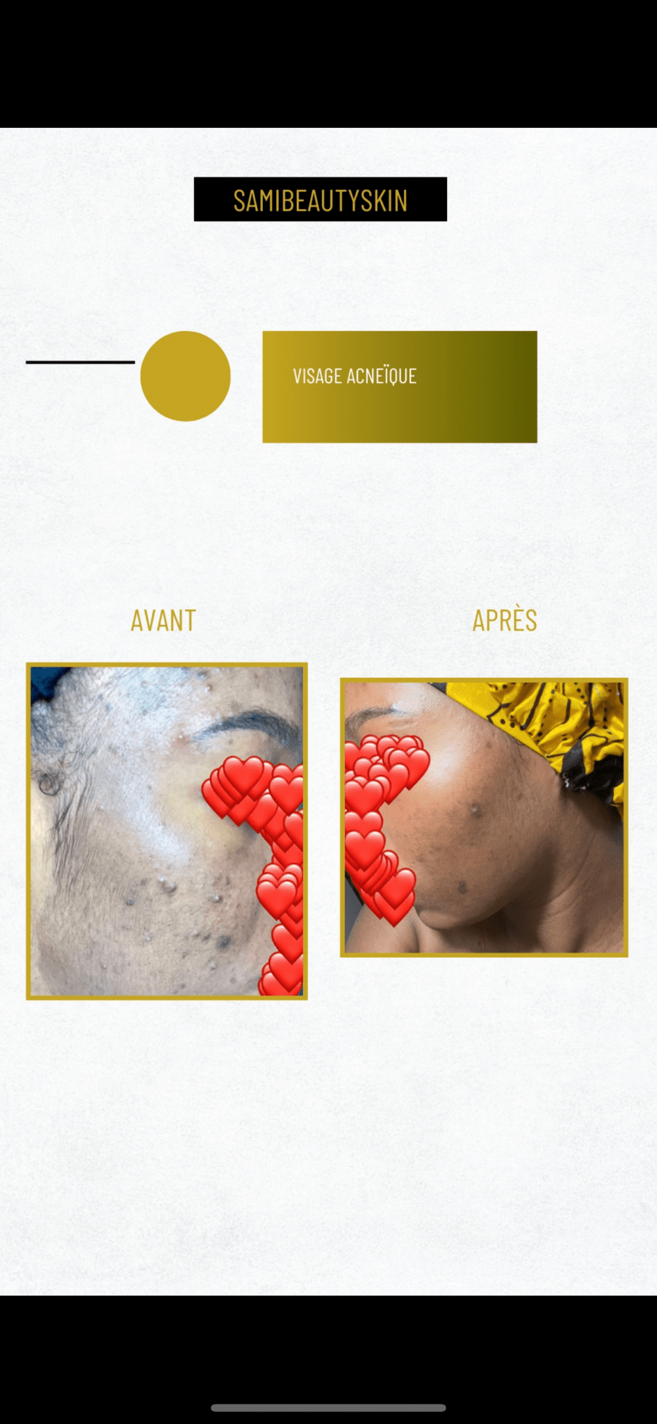 Serum Anti tâches