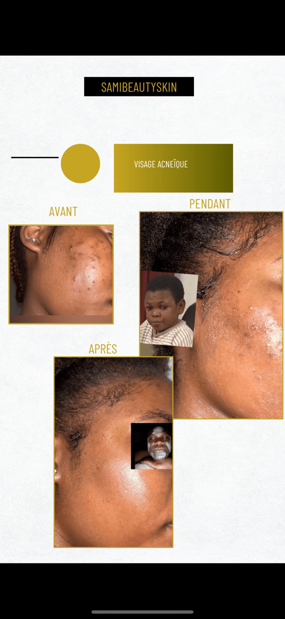 Pads toner peau lisse & sans bouton the perfect pads vitamin B5