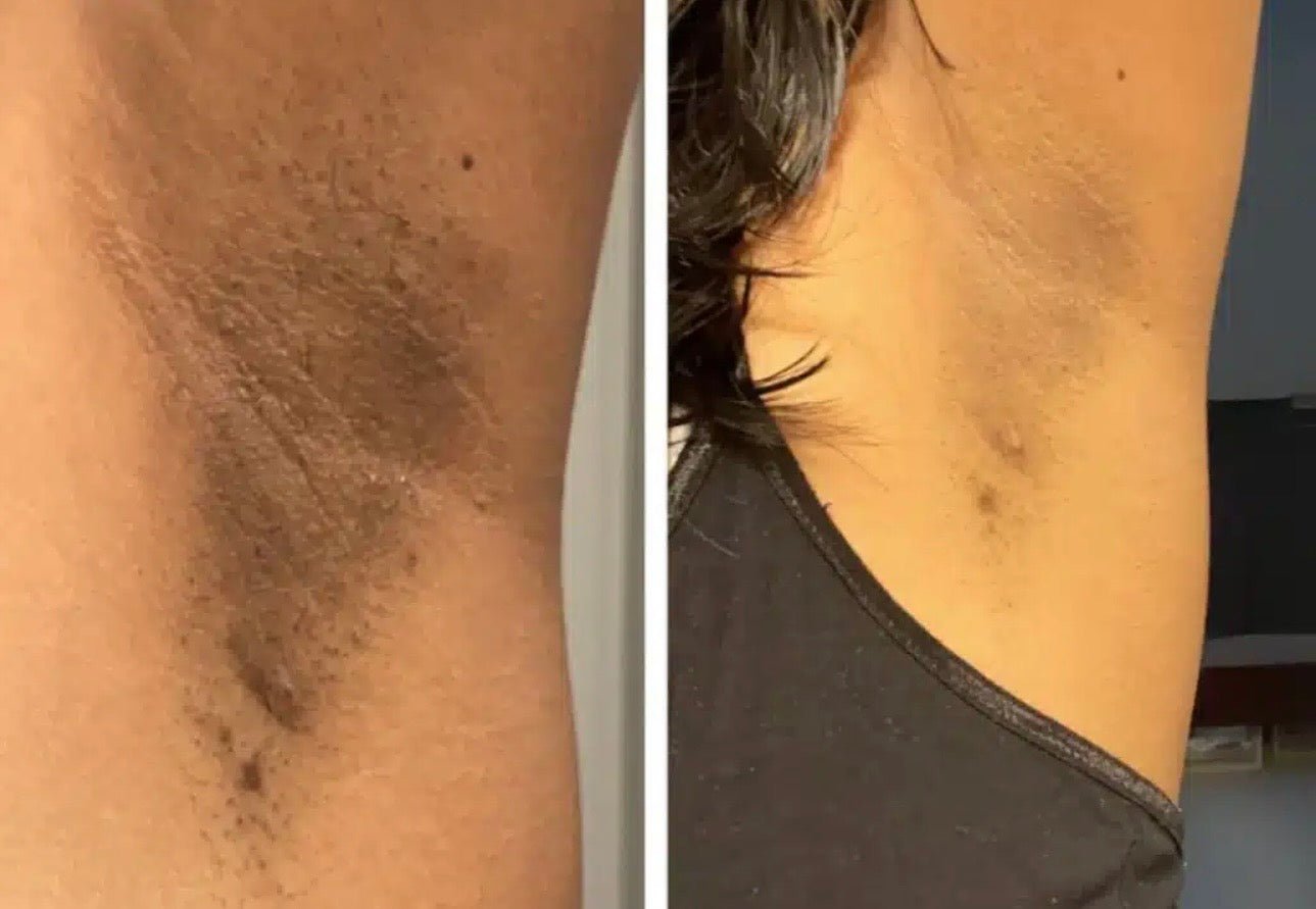 Gommage corps et visage gros format désincruster de point noires 500 ml